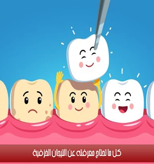 كل ما تحتاج معرفته عن التيجان الخزفية